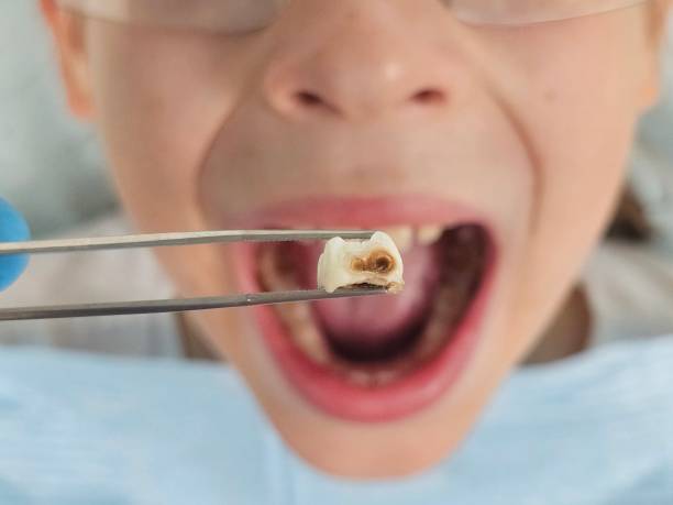 Best Emergency Broken Tooth Repair in Skyline View, PA
